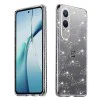 Калъф за OnePlus Nord CE4 Lite - SparkleSkin Series - Clear